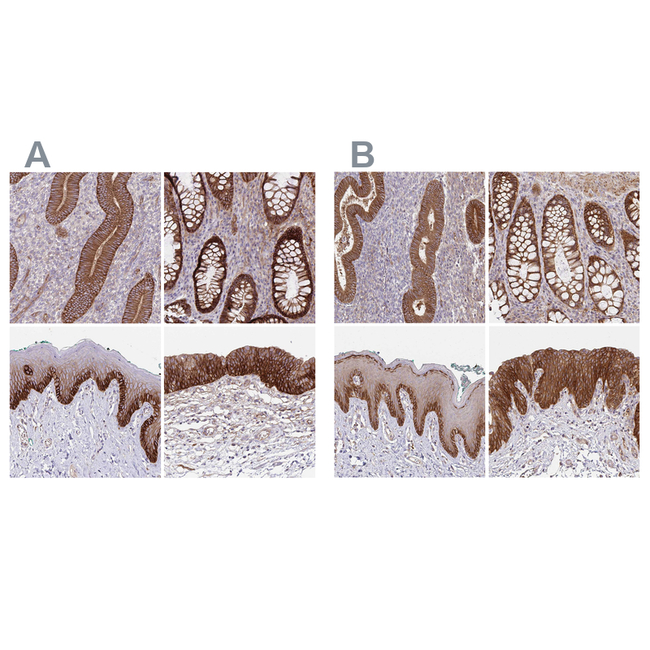 ITGA2 Antibody in Immunohistochemistry (Paraffin) (IHC (P))