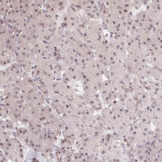 HMGN3 Antibody in Immunohistochemistry (Paraffin) (IHC (P))