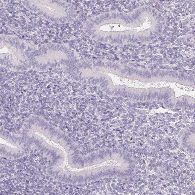 Prostate Specific Acid Phosphatase Antibody in Immunohistochemistry (Paraffin) (IHC (P))