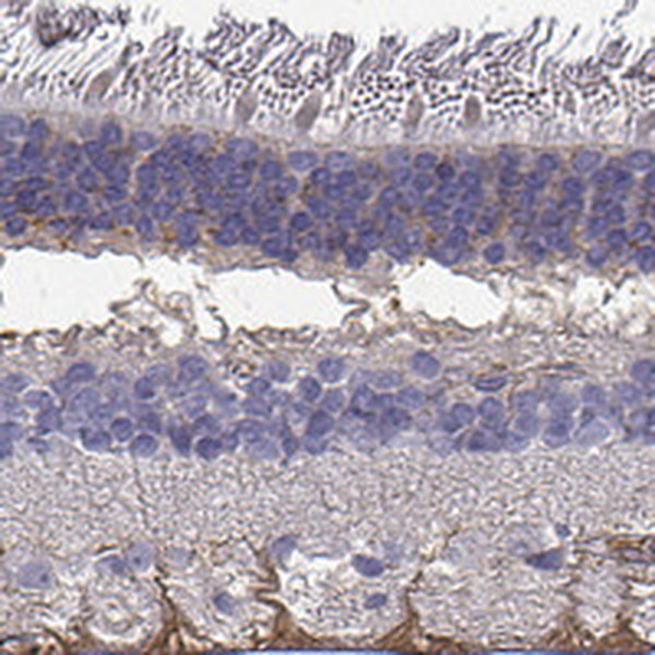 SEMA4F Antibody in Immunohistochemistry (Paraffin) (IHC (P))