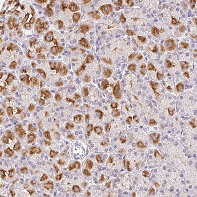 L3MBTL4 Antibody in Immunohistochemistry (Paraffin) (IHC (P))