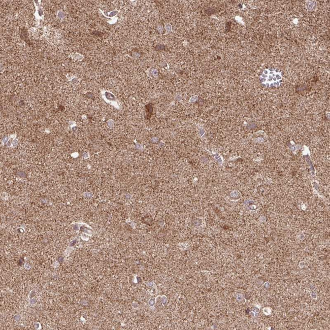 SPRED2 Antibody in Immunohistochemistry (Paraffin) (IHC (P))