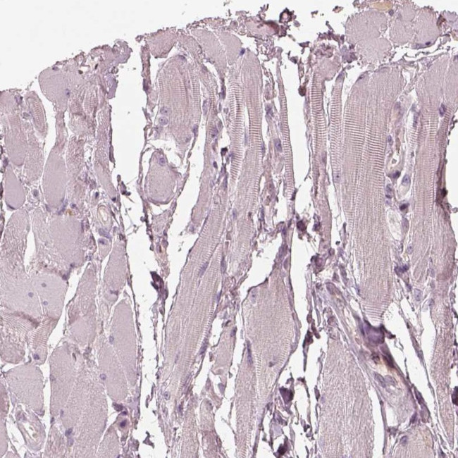 Syntenin 2 Antibody in Immunohistochemistry (Paraffin) (IHC (P))