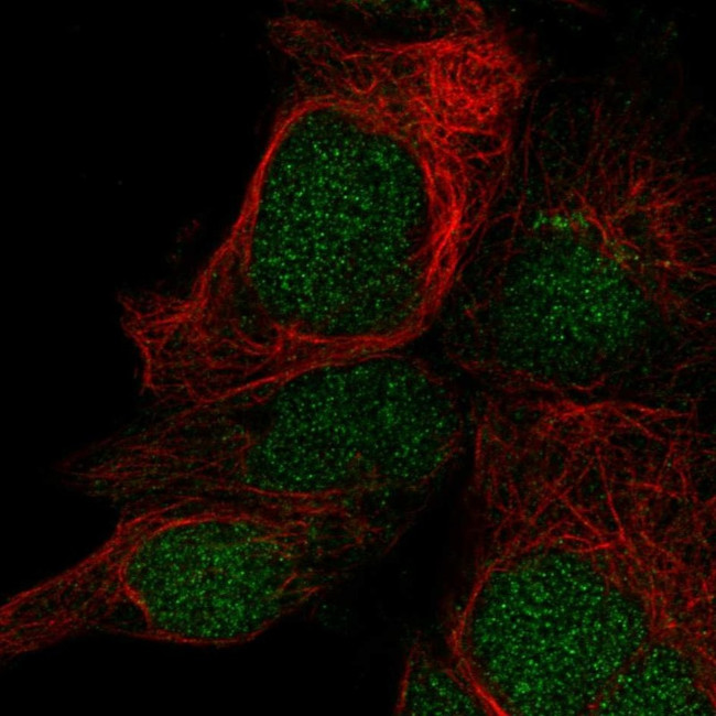 LYSMD1 Antibody in Immunocytochemistry (ICC/IF)