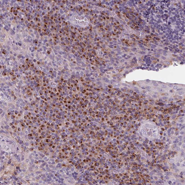 IL9R Antibody in Immunohistochemistry (Paraffin) (IHC (P))