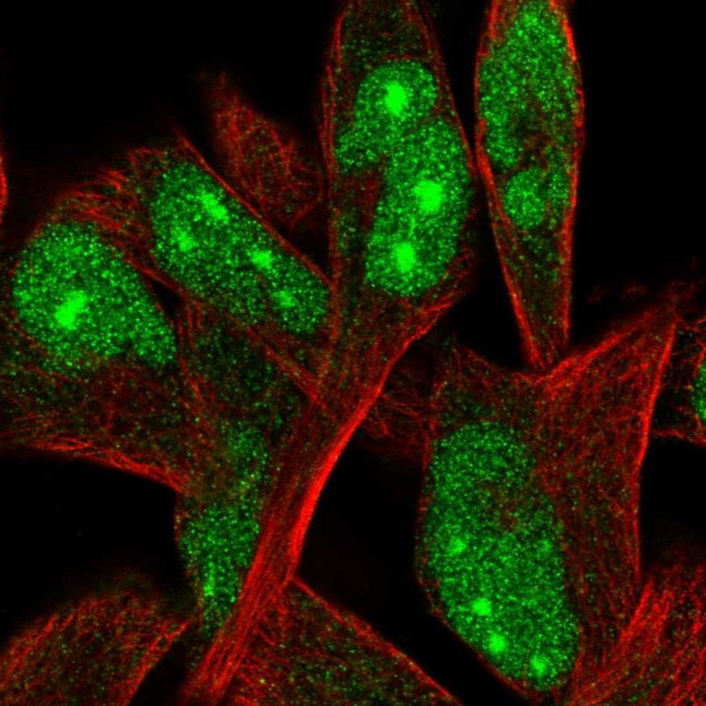 ORC4 Antibody in Immunocytochemistry (ICC/IF)