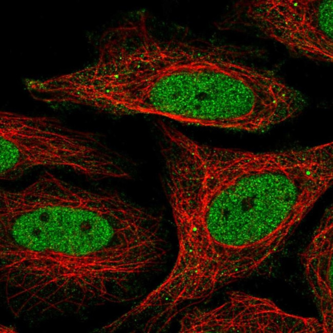 SFMBT1 Antibody in Immunocytochemistry (ICC/IF)