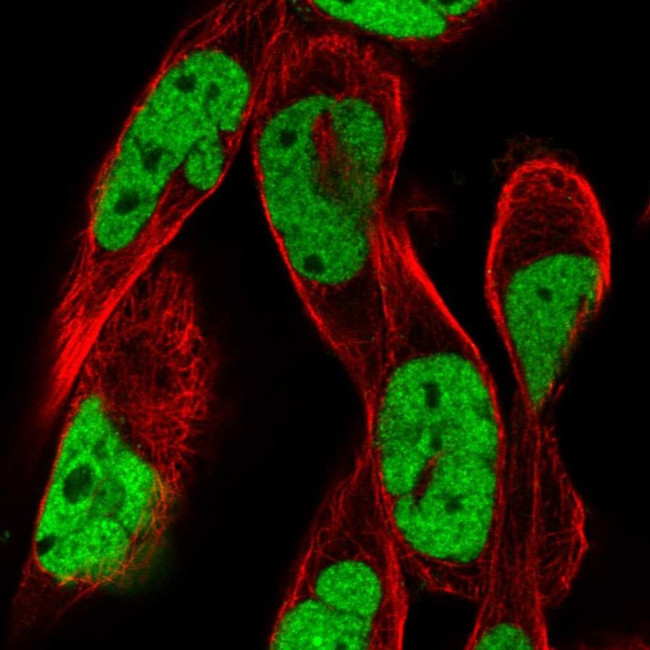 RSF1 Antibody in Immunocytochemistry (ICC/IF)