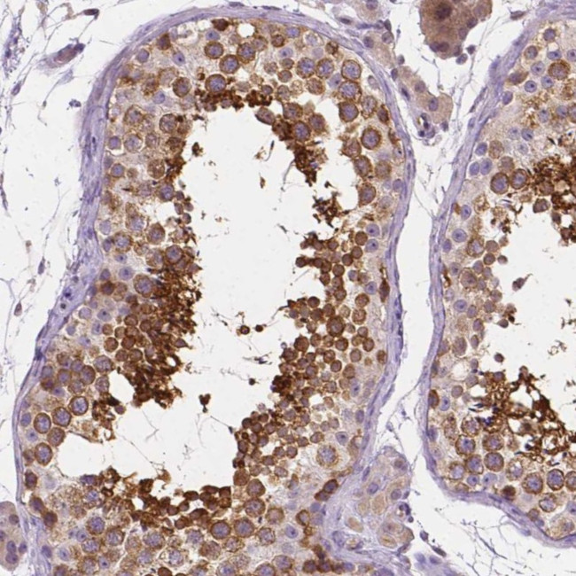 SSSCA1 Antibody in Immunohistochemistry (Paraffin) (IHC (P))