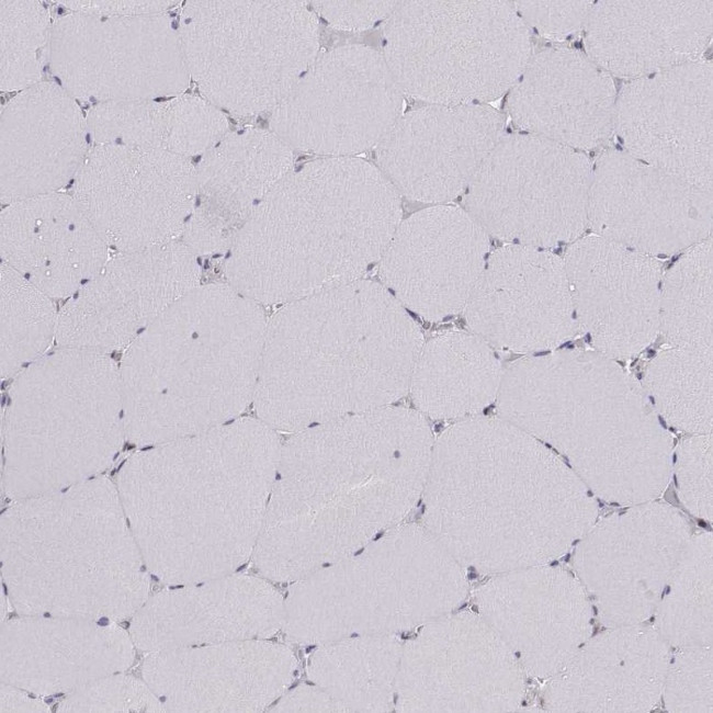 SCML2 Antibody in Immunohistochemistry (Paraffin) (IHC (P))