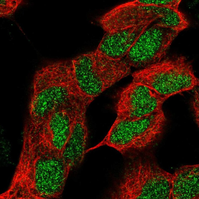 ZNF184 Antibody in Immunocytochemistry (ICC/IF)