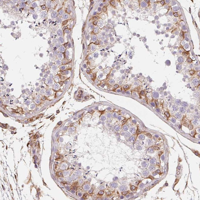 Prosapip2 Antibody in Immunohistochemistry (Paraffin) (IHC (P))