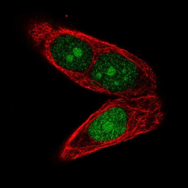 Aprataxin Antibody in Immunocytochemistry (ICC/IF)