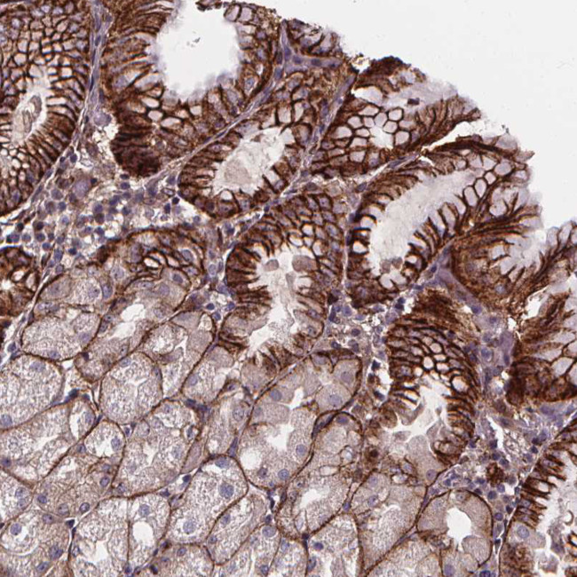 AEBP1 Antibody in Immunohistochemistry (Paraffin) (IHC (P))