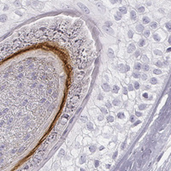 KRT72 Antibody in Immunohistochemistry (Paraffin) (IHC (P))