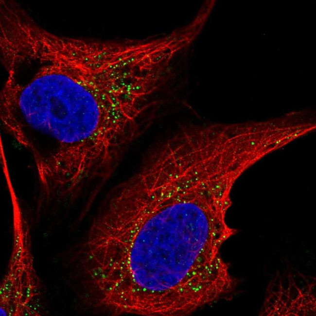 ST6GALNAC5 Antibody in Immunocytochemistry (ICC/IF)