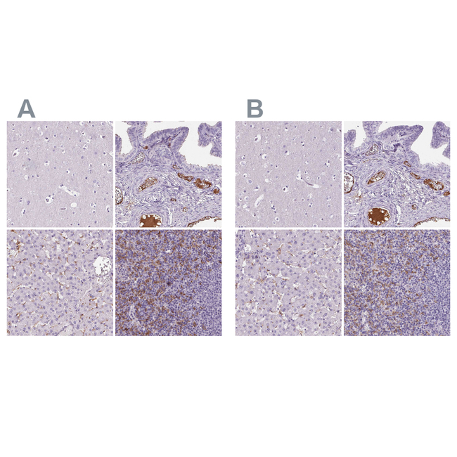 AIM Antibody in Immunohistochemistry (Paraffin) (IHC (P))