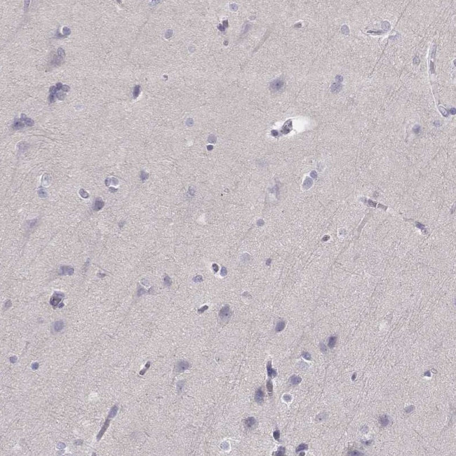 P2Y10 Antibody in Immunohistochemistry (Paraffin) (IHC (P))