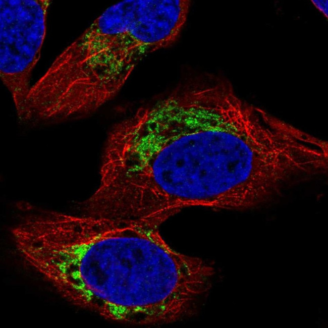 HADHB Antibody in Immunocytochemistry (ICC/IF)