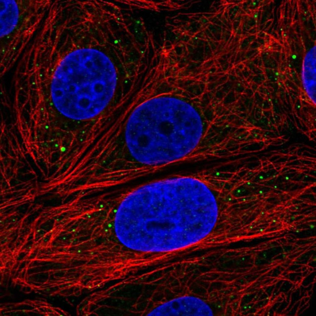 EDC3 Antibody in Immunocytochemistry (ICC/IF)