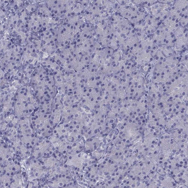 CCDC11 Antibody in Immunohistochemistry (Paraffin) (IHC (P))