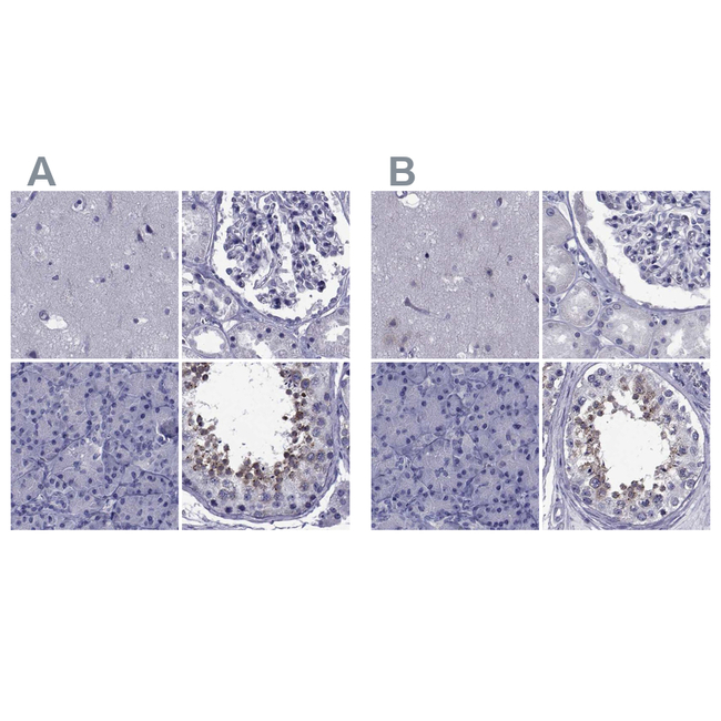 GKAP1 Antibody in Immunohistochemistry (Paraffin) (IHC (P))