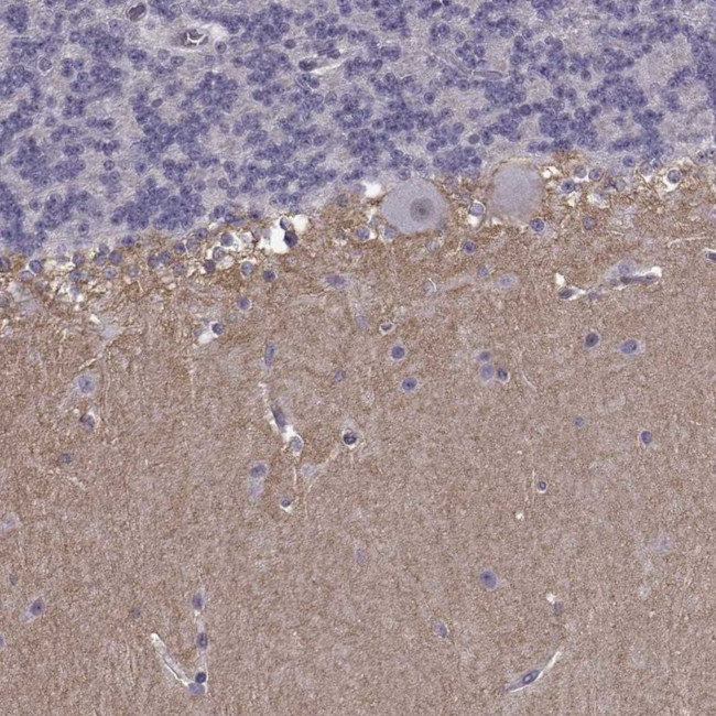 SLCO3A1 Antibody in Immunohistochemistry (Paraffin) (IHC (P))