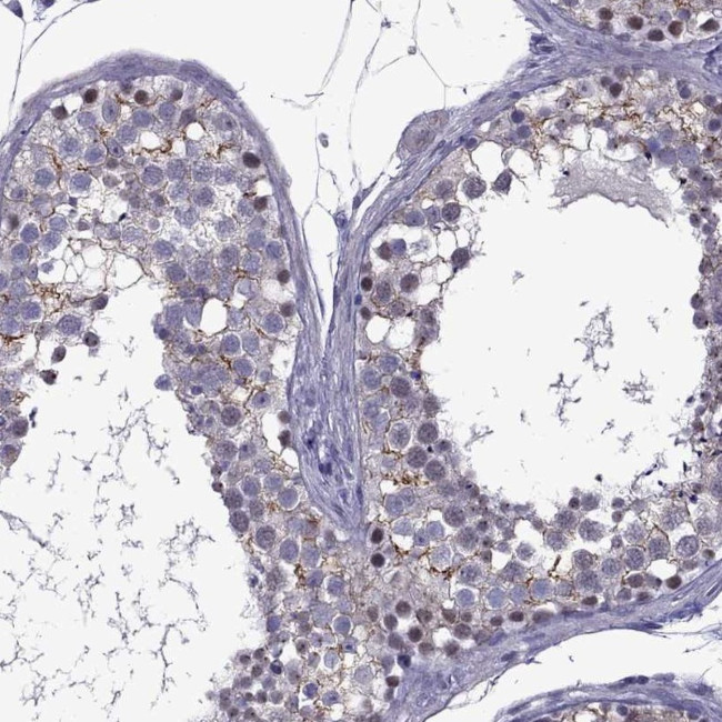 ZNF646 Antibody in Immunohistochemistry (Paraffin) (IHC (P))