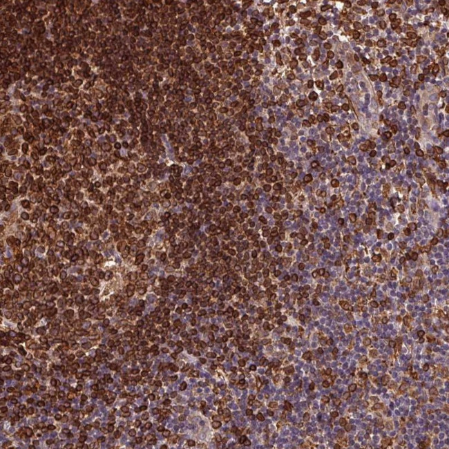 RNASET2 Antibody in Immunohistochemistry (Paraffin) (IHC (P))