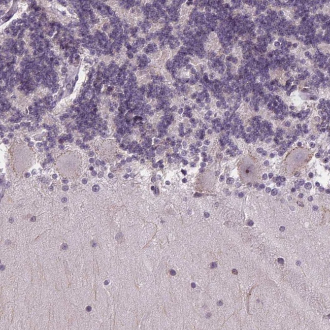 TMEM240 Antibody in Immunohistochemistry (Paraffin) (IHC (P))