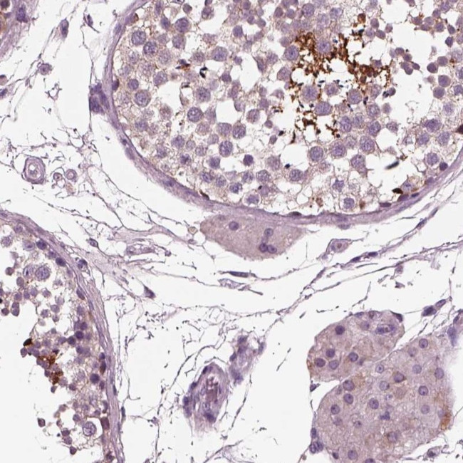AP4M1 Antibody in Immunohistochemistry (Paraffin) (IHC (P))