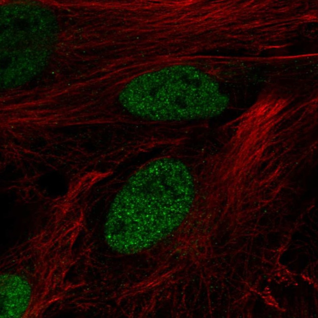DPF3 Antibody in Immunocytochemistry (ICC/IF)