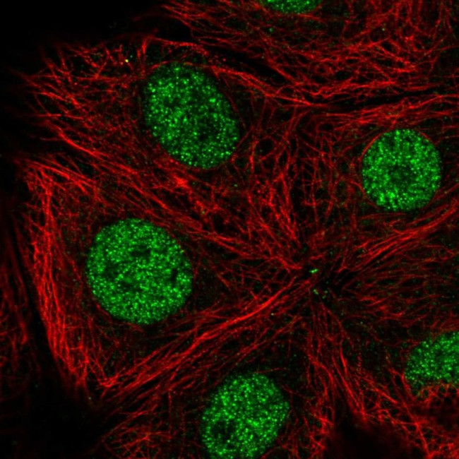 CDK10 Antibody in Immunocytochemistry (ICC/IF)
