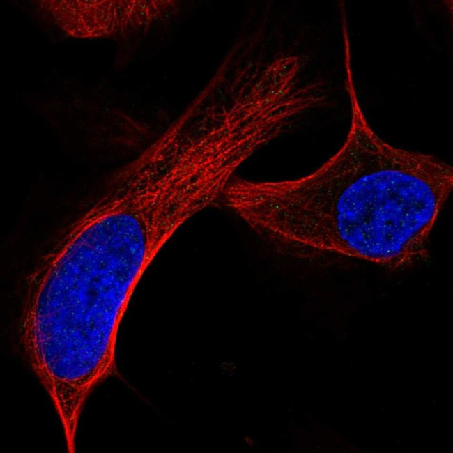 ATM Antibody in Immunocytochemistry (ICC/IF)