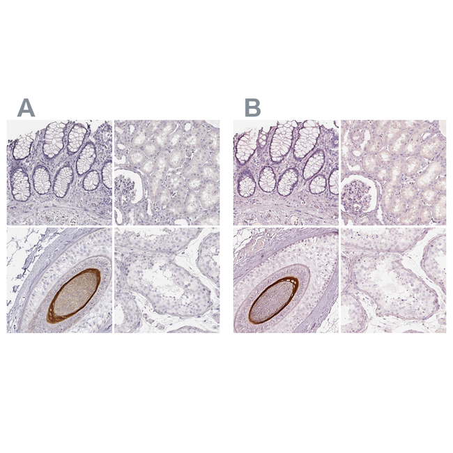 KRT82 Antibody in Immunohistochemistry (Paraffin) (IHC (P))