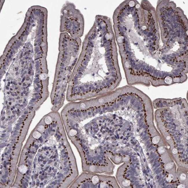 ATP6V1C2 Antibody in Immunohistochemistry (Paraffin) (IHC (P))