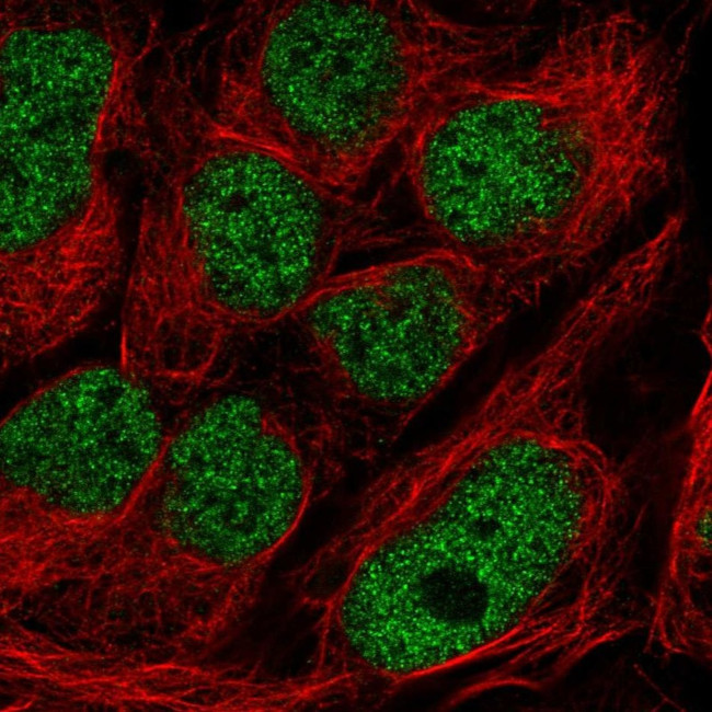 GMEB2 Antibody in Immunocytochemistry (ICC/IF)