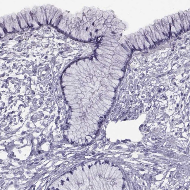 RDM1 Antibody in Immunohistochemistry (Paraffin) (IHC (P))