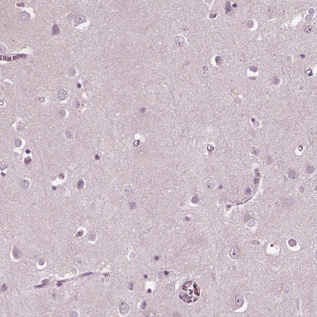SLAMF8 Antibody in Immunohistochemistry (Paraffin) (IHC (P))