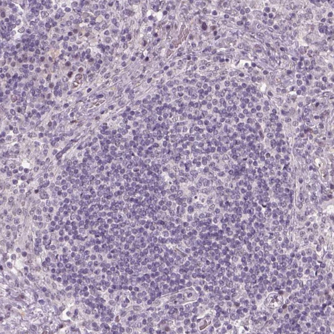 NAT8 Antibody in Immunohistochemistry (Paraffin) (IHC (P))