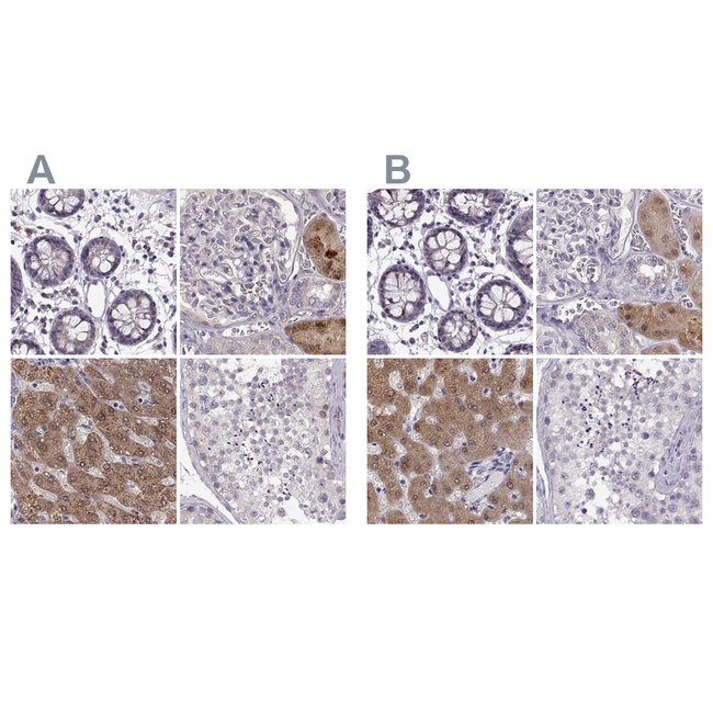 ADH6 Antibody in Immunohistochemistry (Paraffin) (IHC (P))