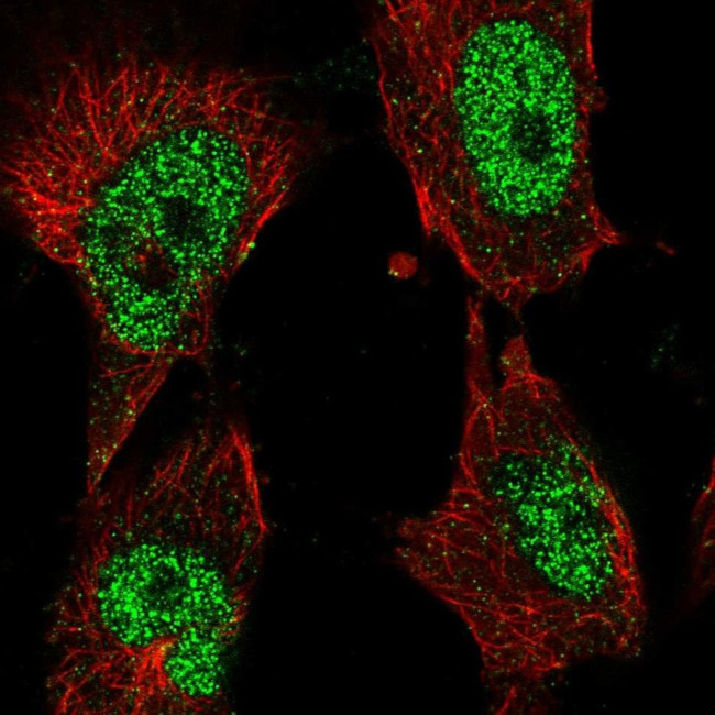 POLK Antibody in Immunocytochemistry (ICC/IF)