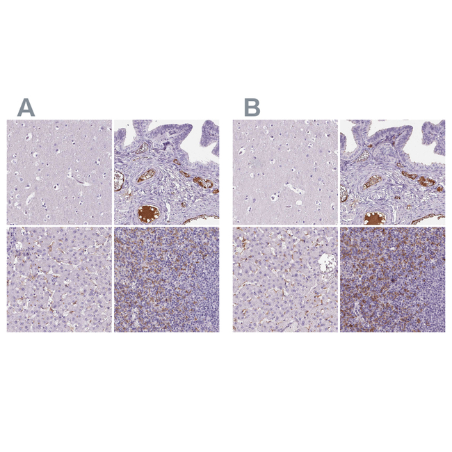 AIM Antibody in Immunohistochemistry (Paraffin) (IHC (P))