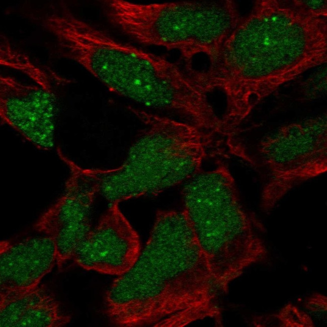 RP11-302B13.5 Antibody in Immunocytochemistry (ICC/IF)