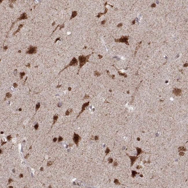 RFT1 Antibody in Immunohistochemistry (Paraffin) (IHC (P))
