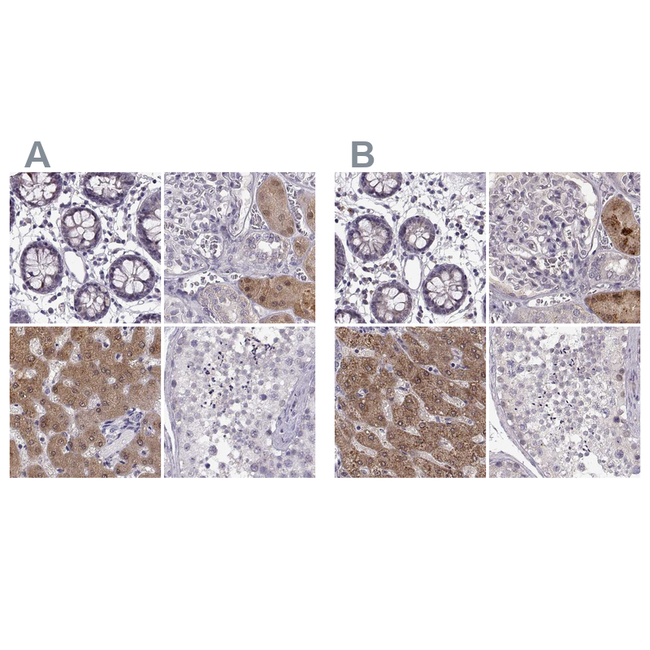 ADH6 Antibody in Immunohistochemistry (Paraffin) (IHC (P))