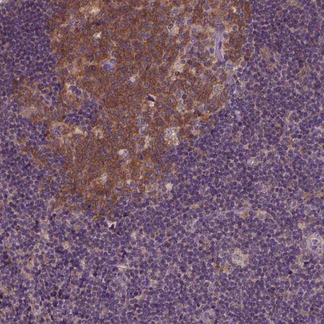 KBTBD8 Antibody in Immunohistochemistry (Paraffin) (IHC (P))