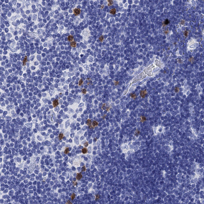 CD150 Antibody in Immunohistochemistry (Paraffin) (IHC (P))