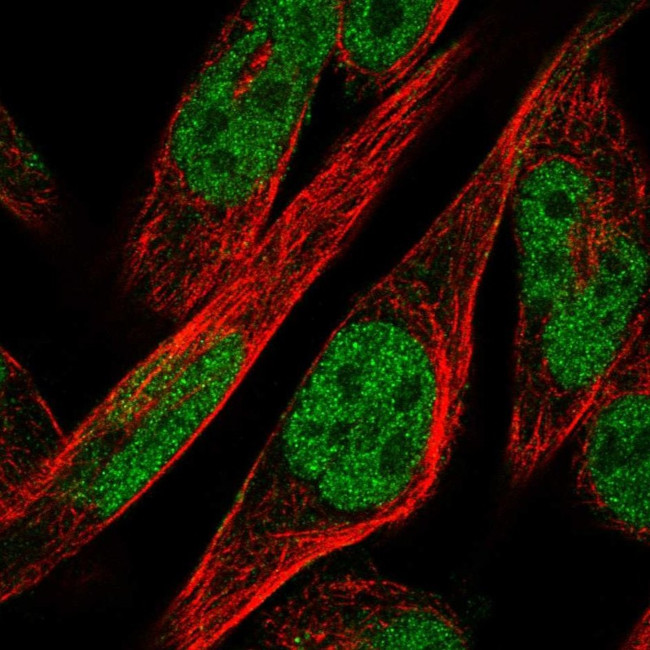 ZNF594 Antibody in Immunocytochemistry (ICC/IF)