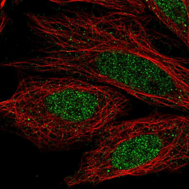 CCDC36 Antibody in Immunocytochemistry (ICC/IF)
